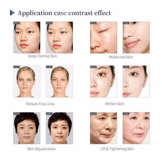 8 in 1 Stationary Oxygen Infusion Beauty Machine Hydra Oxygen LED Light Facial Skin Care SPA600